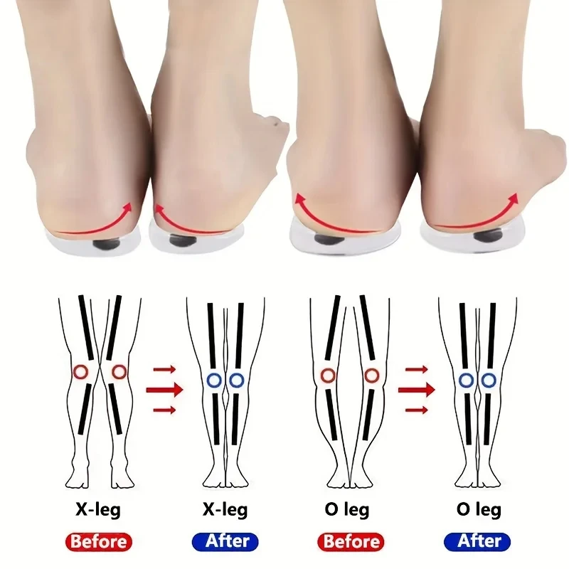 Women Shoes Types - 1 paar Orthopädische Einlegesohlen für Füße