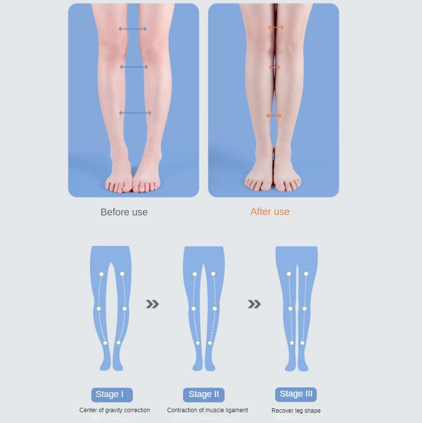 PU Orthesen Einlegesohle Arch  – Women Shoes Types Bewertung und Preis